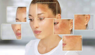 Los tratamientos que mejoran la apariencia de la piel