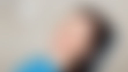 Diş Çekimi Sonrası Nelere Dikkat Edilmeli?