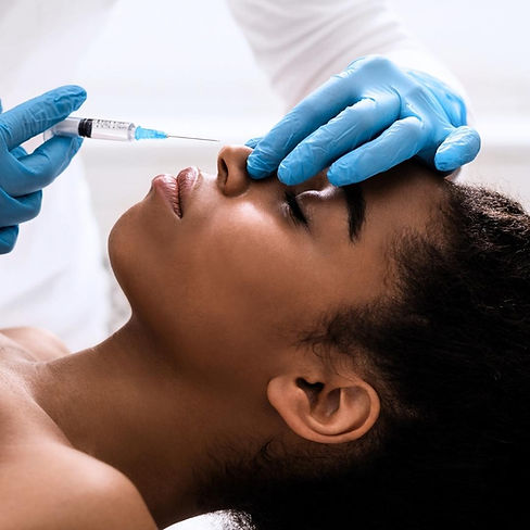 פיסול אף בחומצה היאלורונית ללא ניתוח בנתניה מרכז אסתטיקה אוסטראה