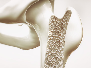 Osteoporosis