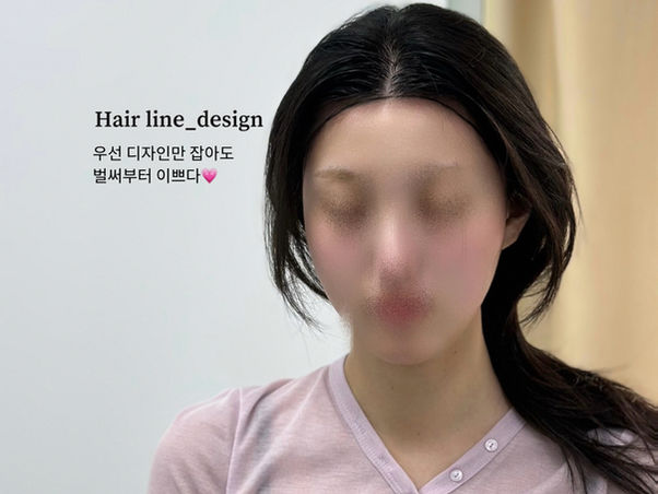 안양헤어라인문신 알아보기 전 꼭 확인할 3가지