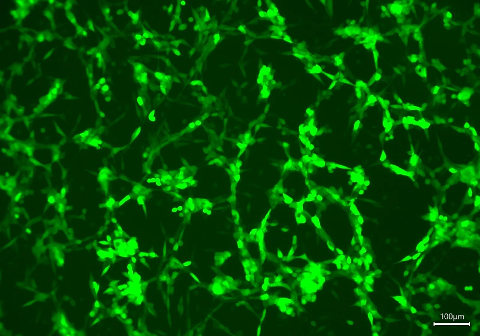 Expression of enhanced green fluorescent protein (eGFP) using Reprogram's mRNA-LNP platform.