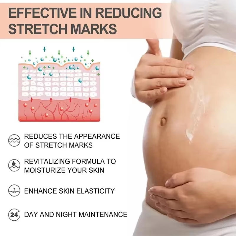 Thumbnail: BumpGlow™ Stretch Mark Prevention Oil