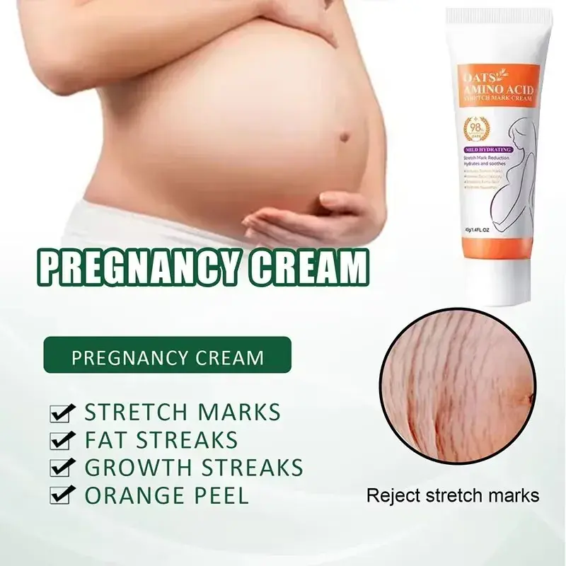 Thumbnail: Stretch Marks Permanent Removal Cream Eliminate Body Belly Stretch Marks Swellin