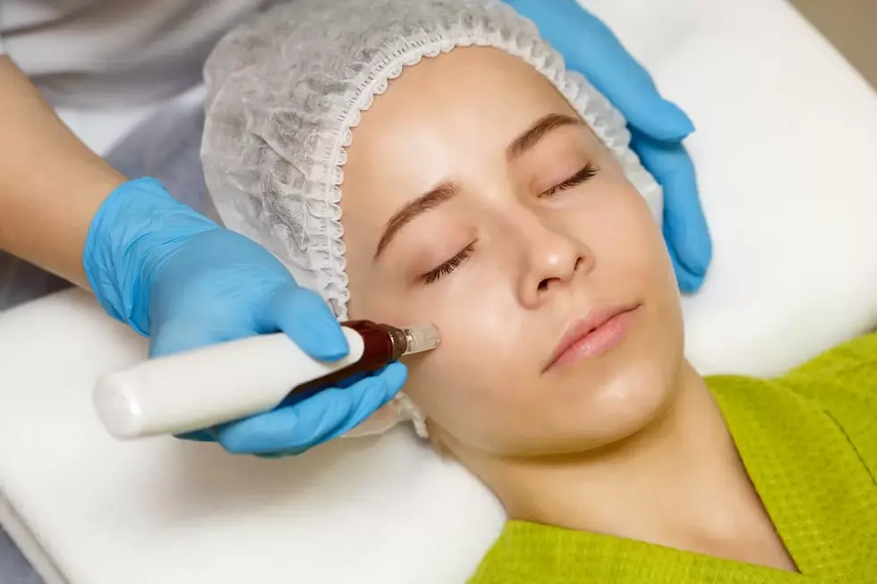 Microneedling Therapy