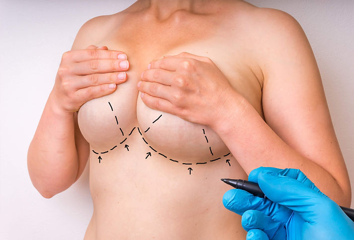 Chennai’s expert breast implant surgery with minimal scarring.