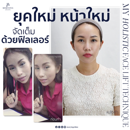 650825filler_คุณยุ้ย.png