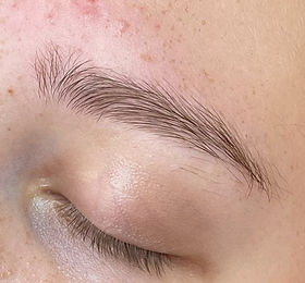 Voor links Tess browlift_edited_edited_e