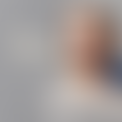 Ácido hialurônico e a restauração dos pilares faciais.