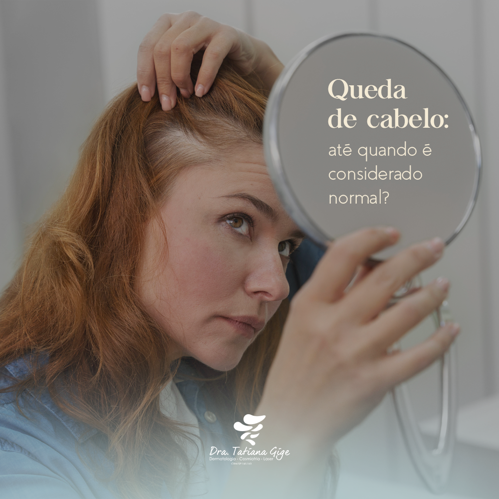 Queda de cabelo: até quando é considerado normal?