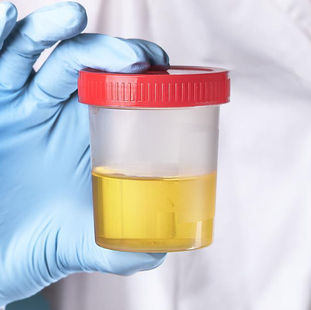 Everything You Need to Know About DOT Testing in Roseville