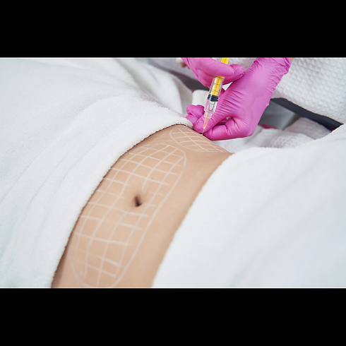 Your paragraph text (3).png