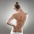 scoliosis