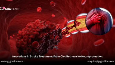 Innovations in Stroke Treatment: From Clot Retrieval to Neuroprotection