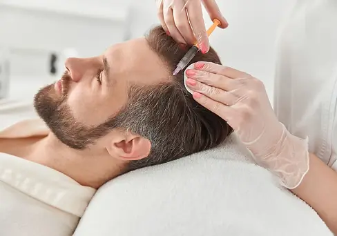man prevents a male pattern baldness with mesotherapy for hair loss
