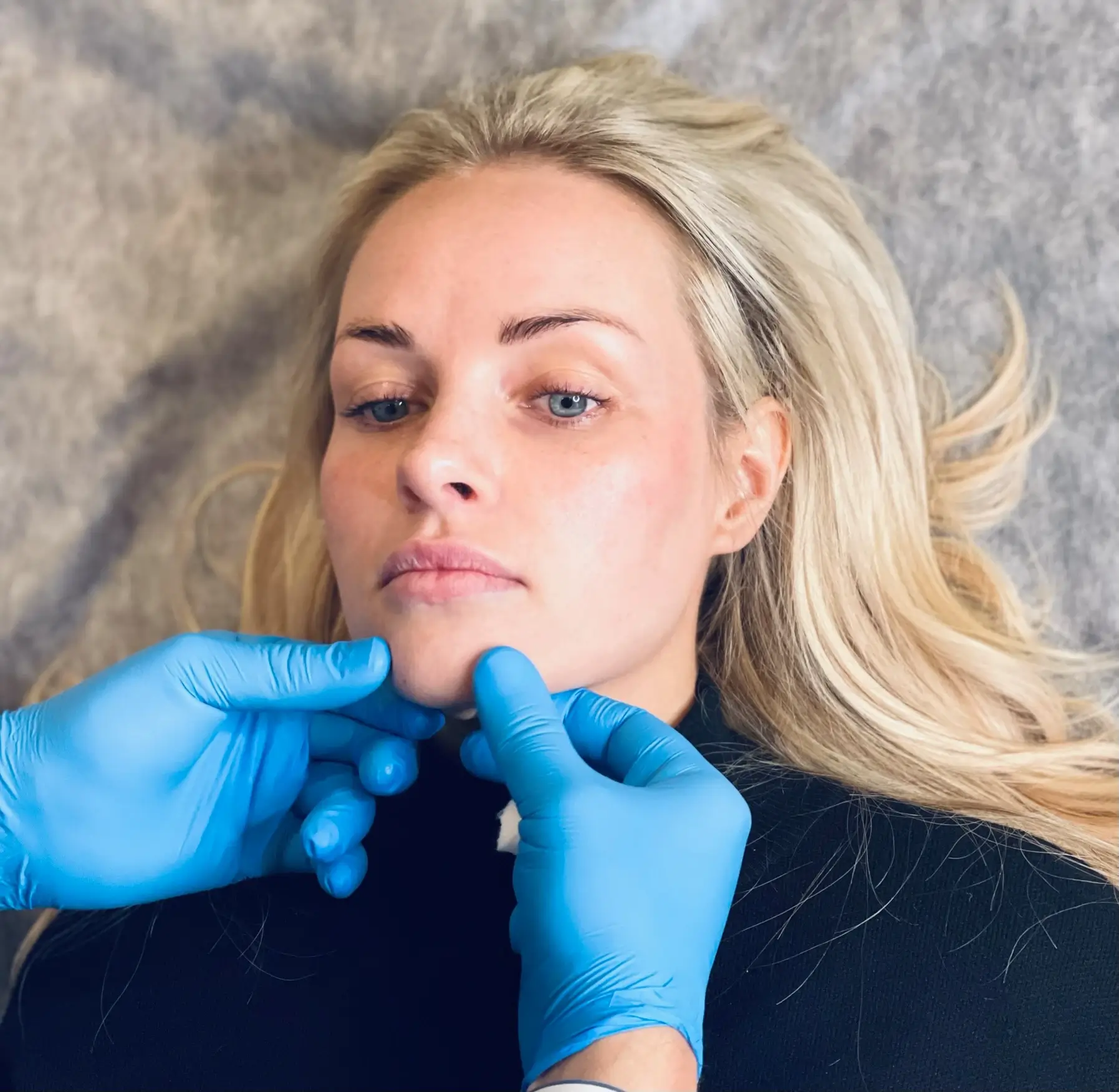 young blond patient gets examined before the botox for pebbled chin treatment