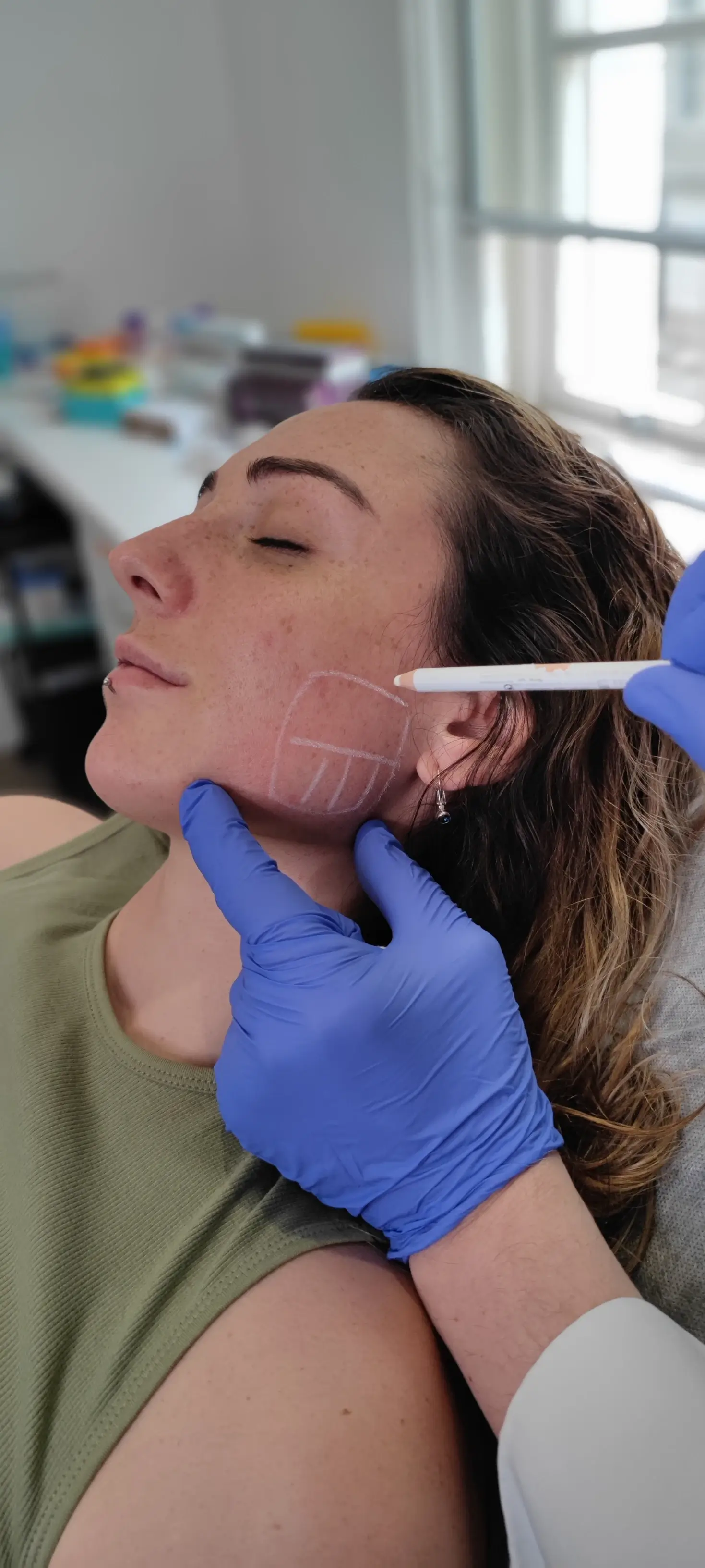 doctor prepares the face area of a young woman for a botox injection