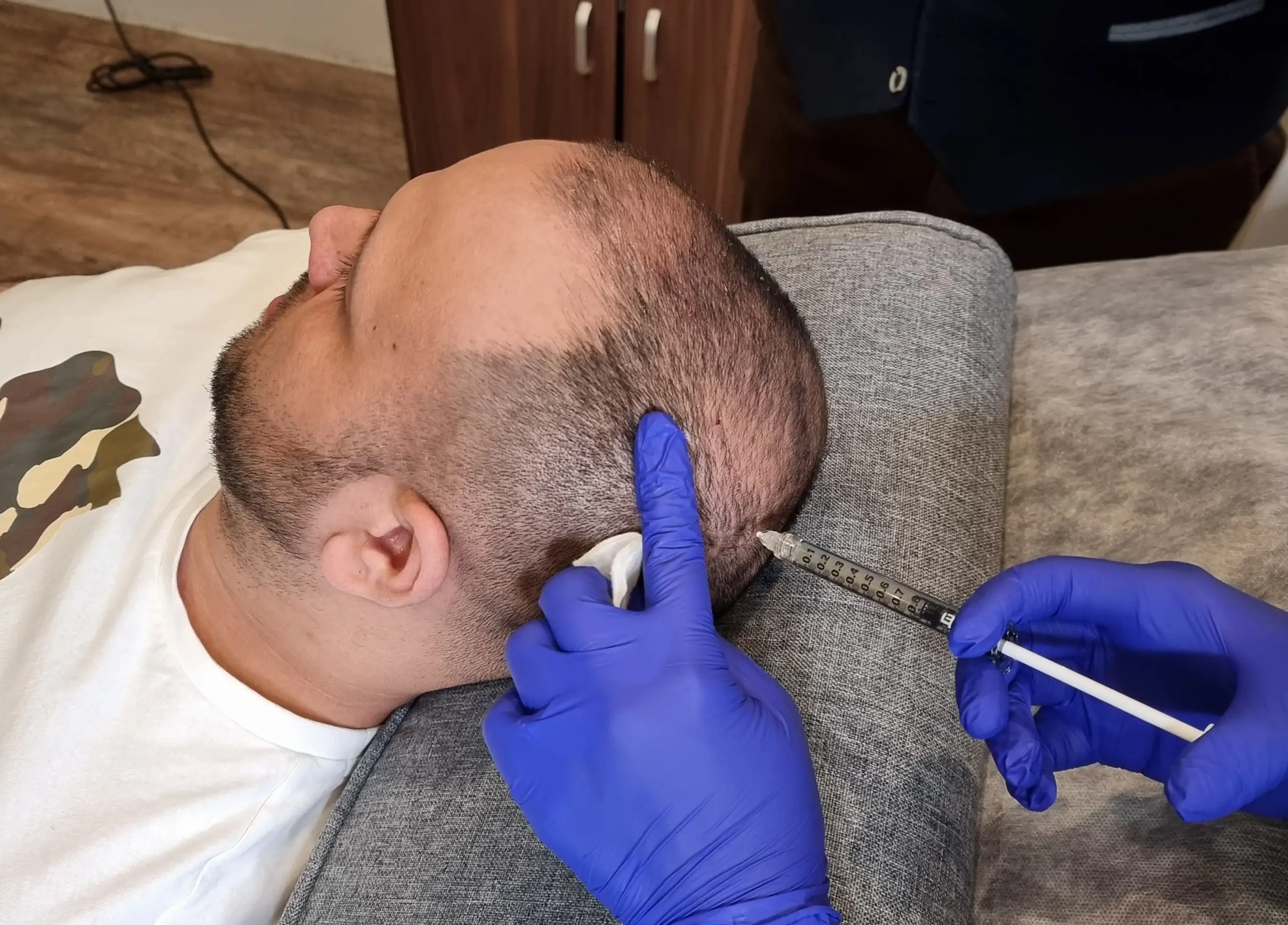 man with hair loss gets hair loss treatment