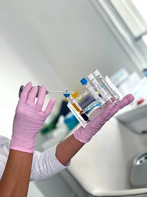 medical professional holds a tray with blood samples for prp anti-hair loss treatment