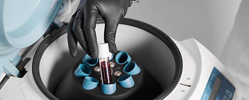 What to Expect at Your O-Shot Appointment