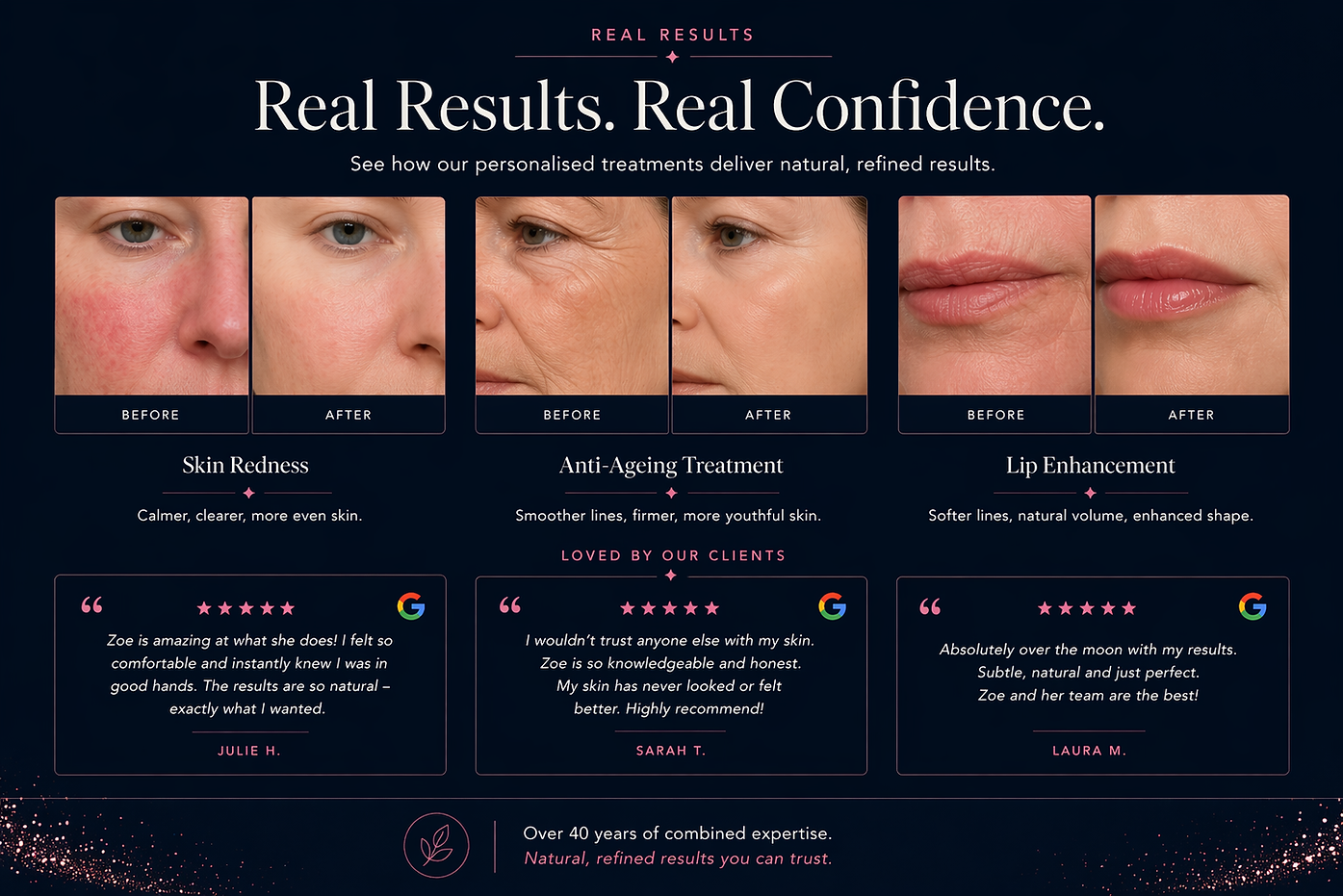 real results zoe mizon