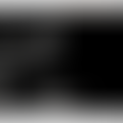 Massage Myths: Drinking Water Post Massage