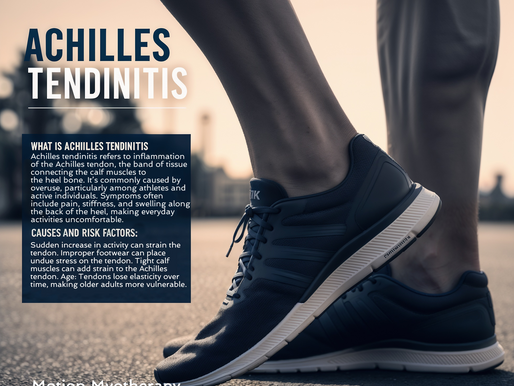 Understanding and Managing Achilles Tendinitis: A Comprehensive Guide
