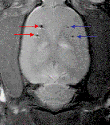 rat brain with retinal epithelial cells.gif