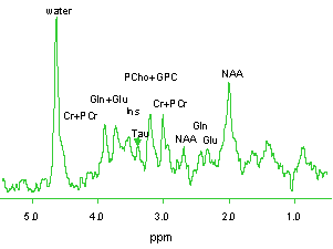 fmri proton metabolite spectrum.gif