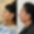 Side-by-side comparison of a woman's face, before and after morpheus8 treatment. The left shows sagging skin; the right appears smoother and tighter skin. Text: "Before" and "After".