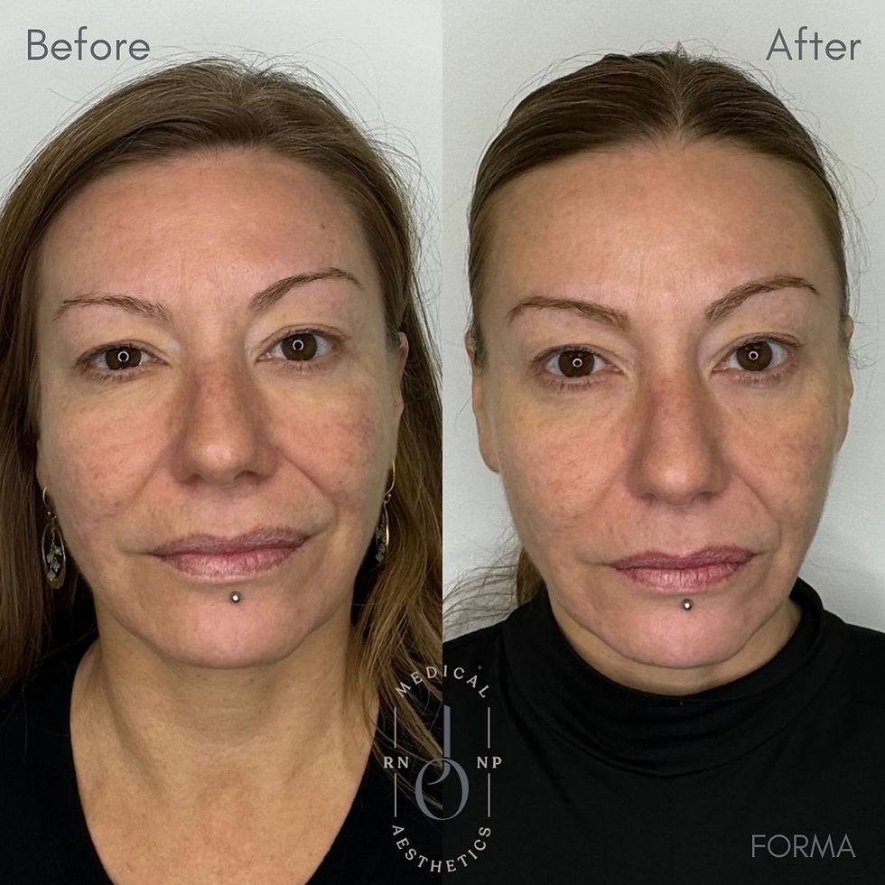 The Best Skin Treatments in Winnipeg in Your 30s, 40s, and 50s
