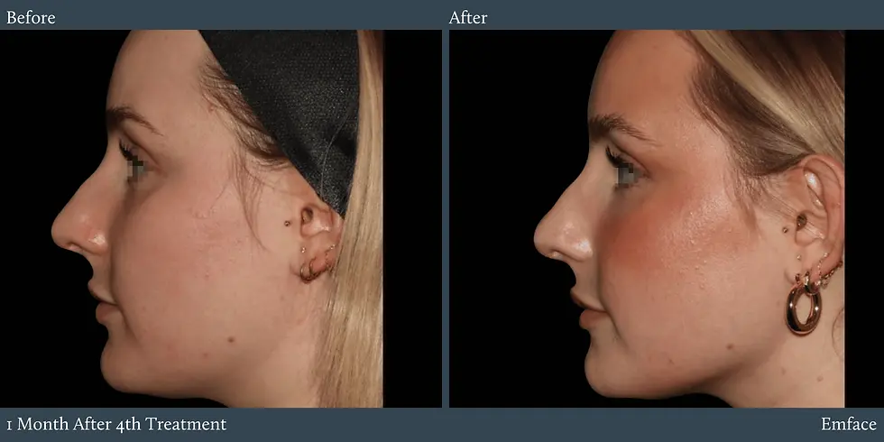 BeforeAfter-website-1-2