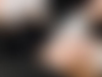 Fotona: el láser que trata desde arrugas hasta caída de cabello