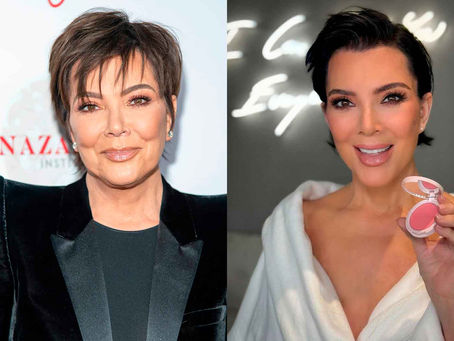 El antes y después de Kris Jenner: ¿Qué tratamientos rejuvenecedores se ha hecho?