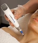 BioRePeel treatment applied to a person's neck