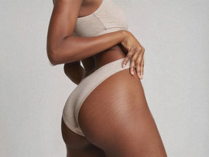 A person in beige underwear poses against a light gray background. The focus is on the skin's natural texture and stretch marks.