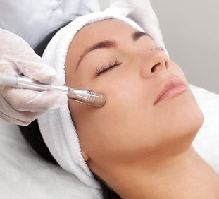 microdermabrasion.jpg