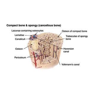 Have You heard of the relevance of Bemer-therapy in the treatment of severe local bone diseases?