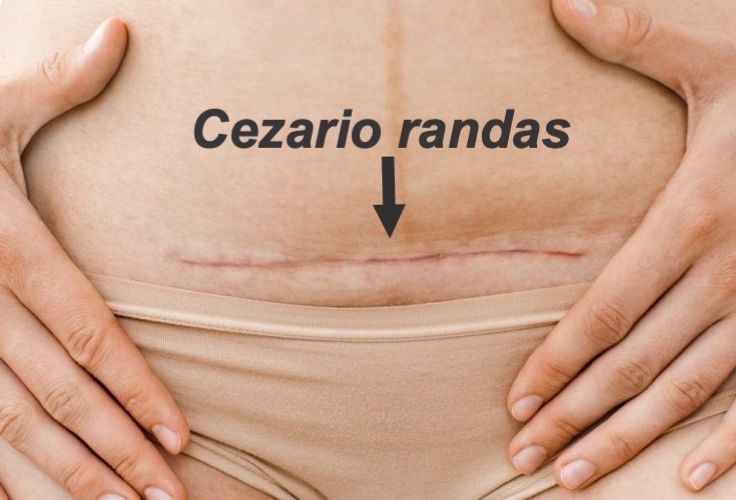 Aplink Pilvą_Po gimdymo