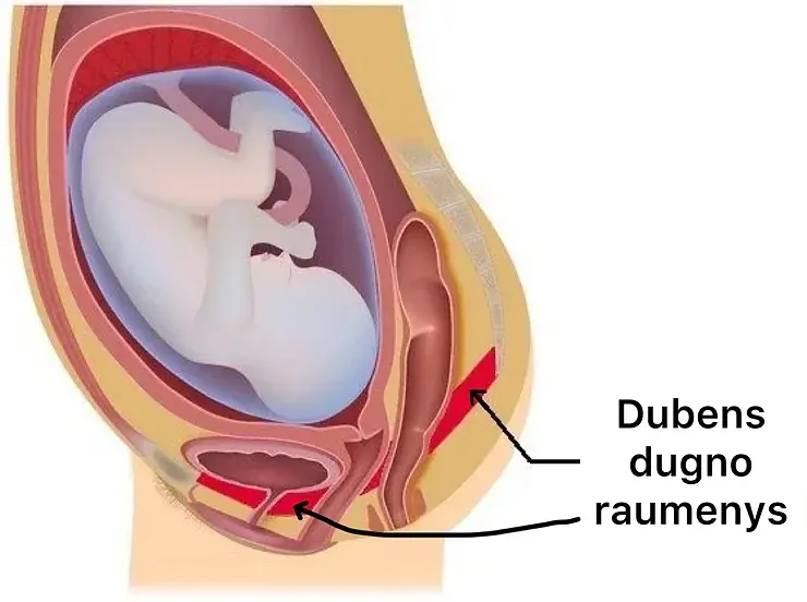 Aplink Pilvą_Nėštukei