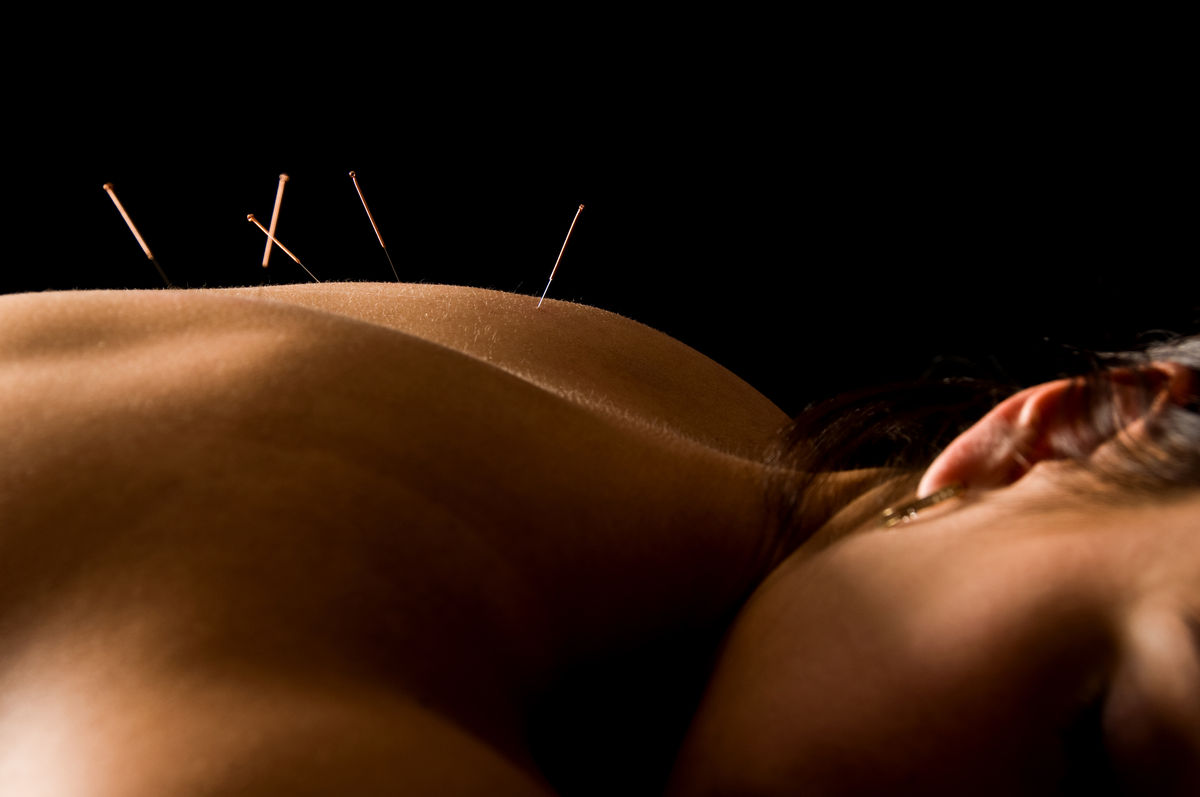 Black Pearl Acupuncture