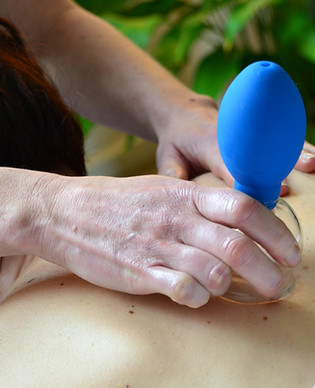 Transformational cupping massage.JPG