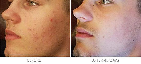 before and after