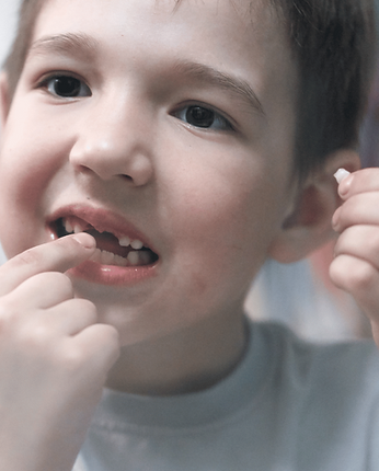 managing early tooth loss in children in South Jersey.png