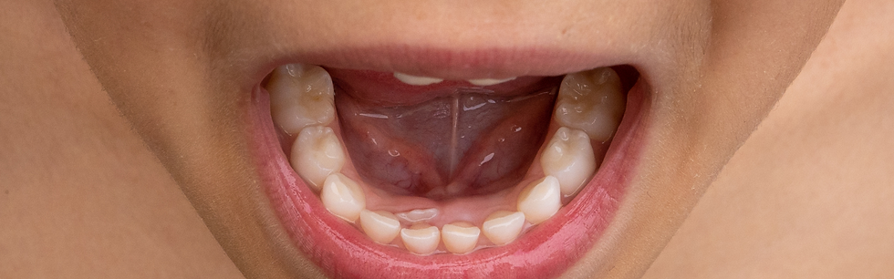 guiding healthy tooth eruption in kids across South Jersey