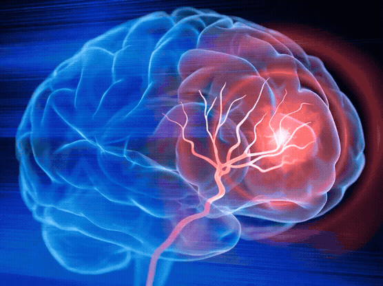 Image to video 丨 Rotate brain in 3d like it was on a turntable. Have the light u.gif