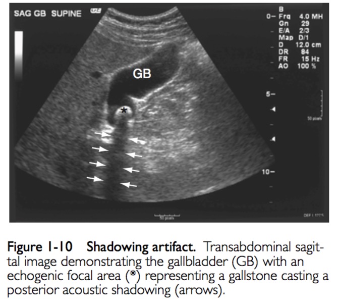 String. Sign Sonogram READING SONOGRAMS - A GUIDE