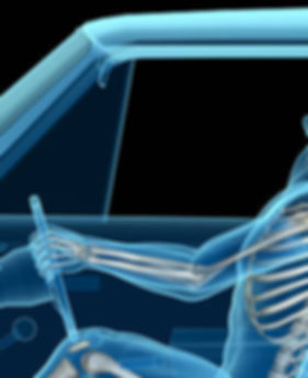 Photo of whiplash