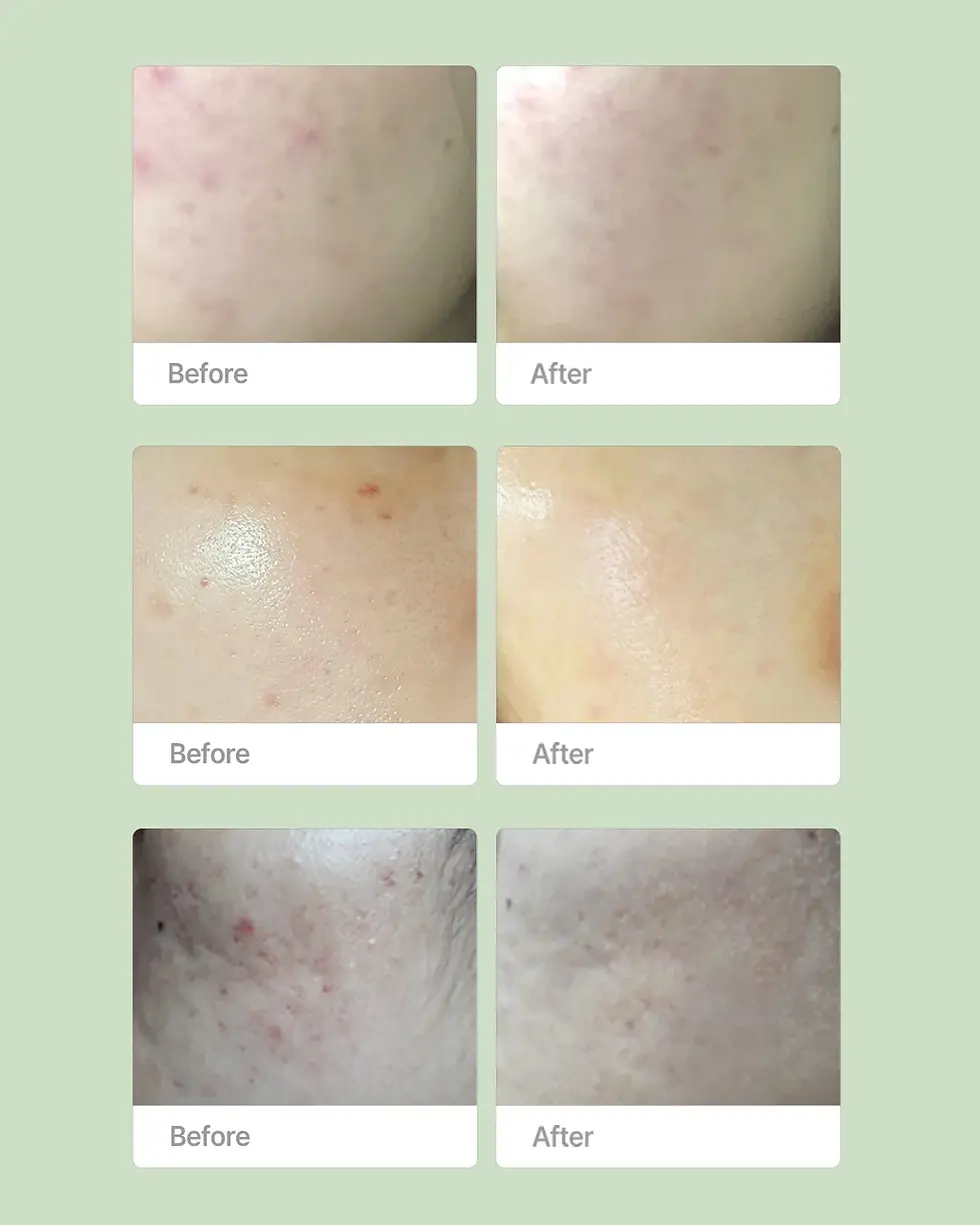 Thumbnail: Purifying Kit - Oxygenceuticals