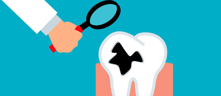 Binicare Water Flosser Creates Great Oral Hygiene